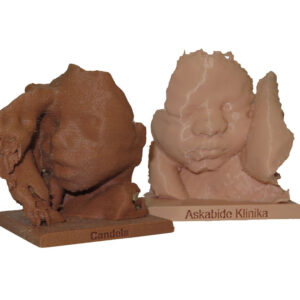 Impresión de la ecografía de tu bebe