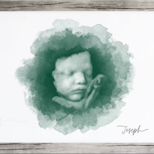 Impresión foto ecograía 3D